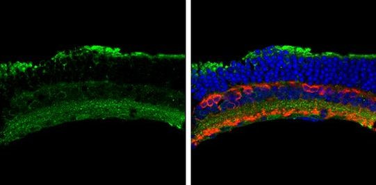 ACVR1 Antibody in Immunohistochemistry (Frozen) (IHC (F))