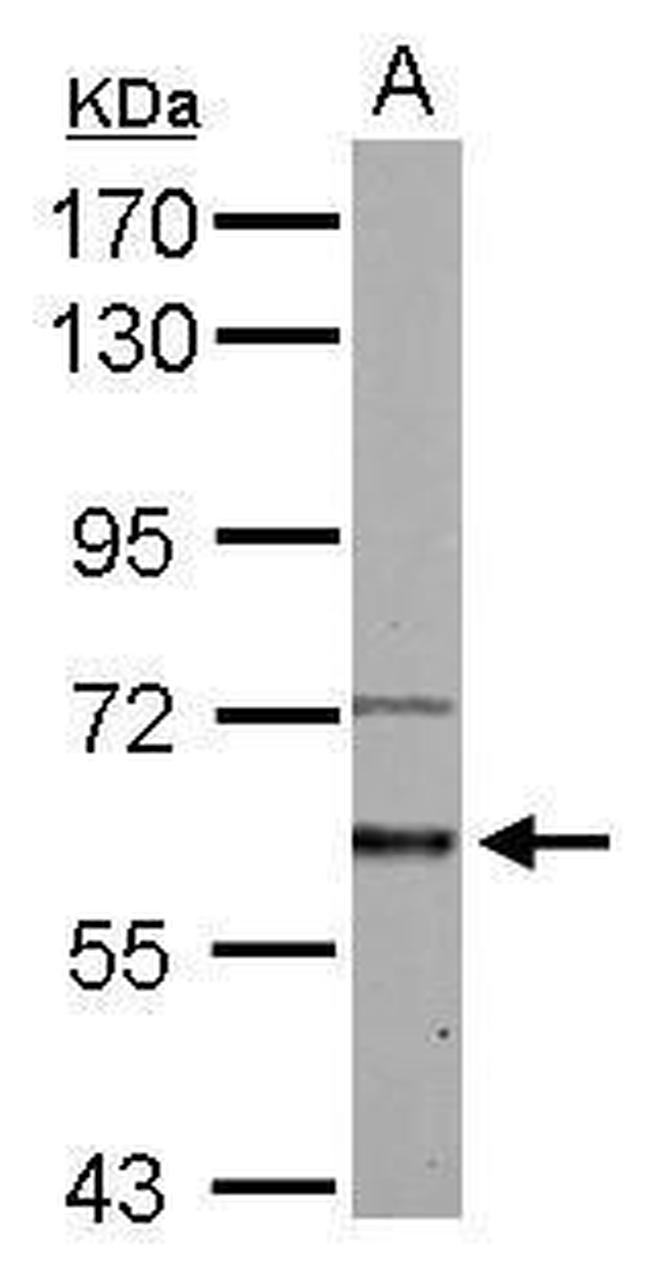 ACVR1 Antibody in Western Blot (WB)