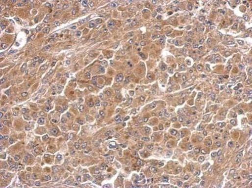 PAK6 Antibody in Immunohistochemistry (Paraffin) (IHC (P))