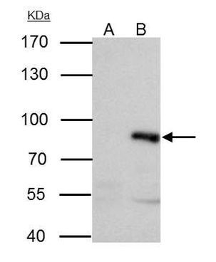 PAK6 Antibody in Immunoprecipitation (IP)