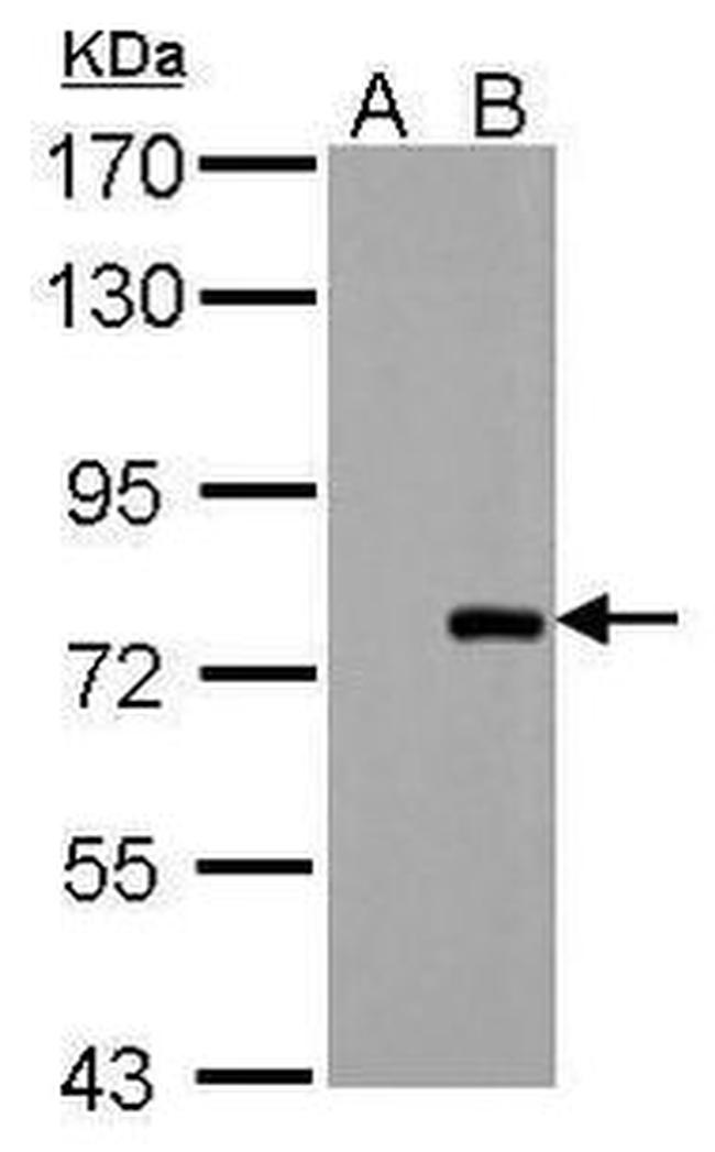 PAK6 Antibody in Western Blot (WB)