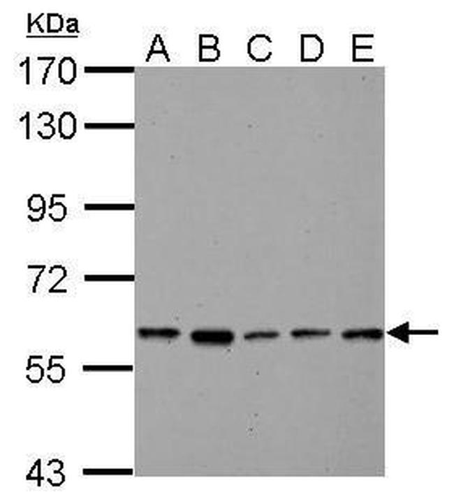 PKLR Antibody in Western Blot (WB)