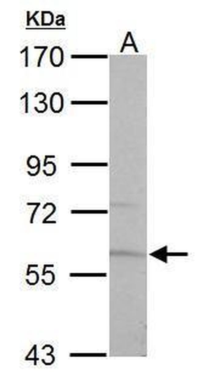 PKLR Antibody in Western Blot (WB)