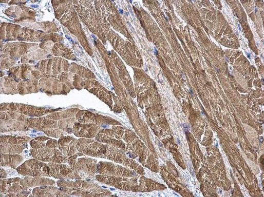 CKMT2 Antibody in Immunohistochemistry (Paraffin) (IHC (P))