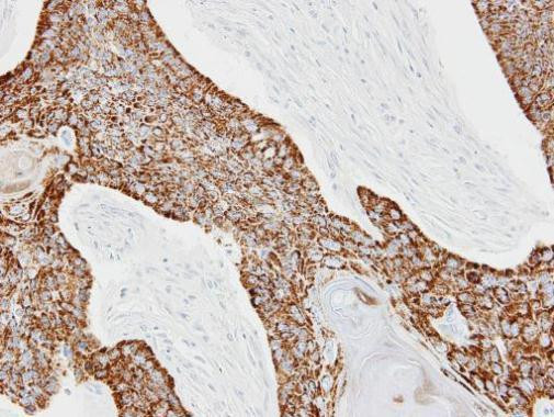 CKMT2 Antibody in Immunohistochemistry (Paraffin) (IHC (P))