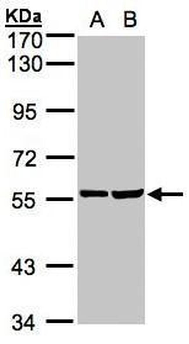 TAB1 Antibody in Western Blot (WB)