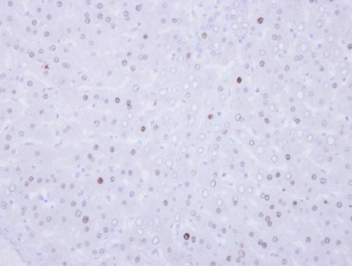 VRK1 Antibody in Immunohistochemistry (Paraffin) (IHC (P))