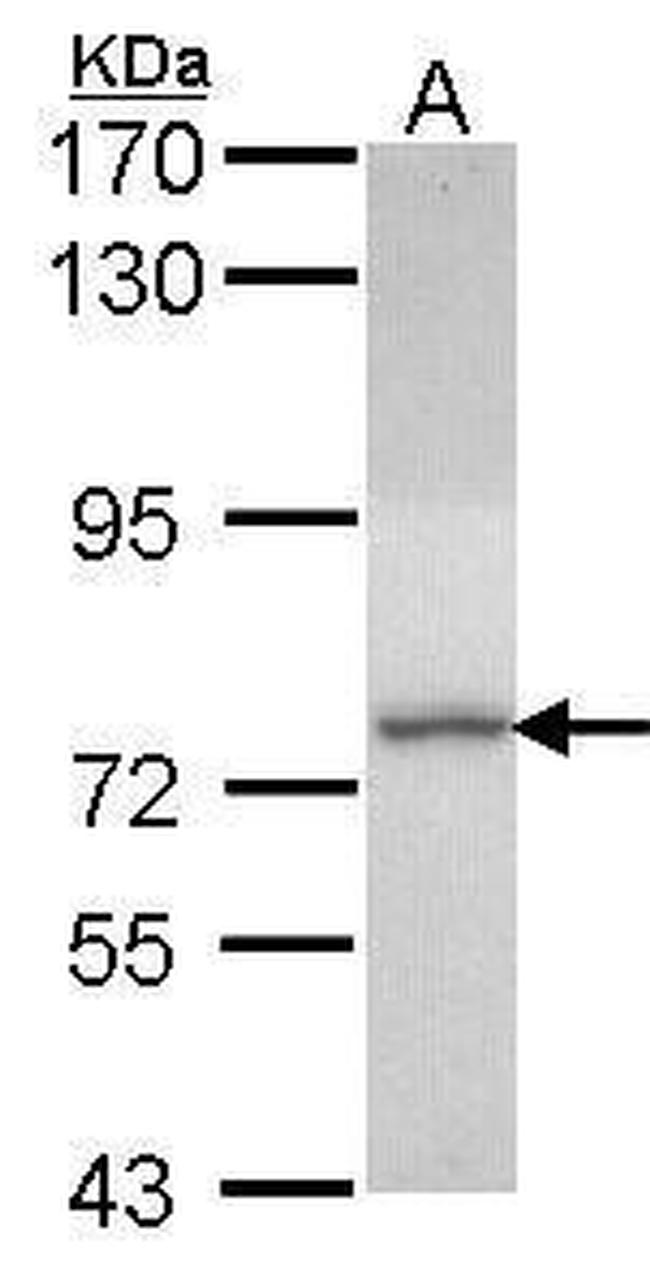 DDX1 Antibody in Western Blot (WB)