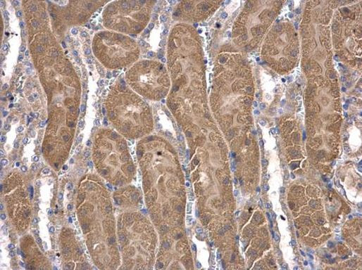 CoA Synthase Antibody in Immunohistochemistry (Paraffin) (IHC (P))