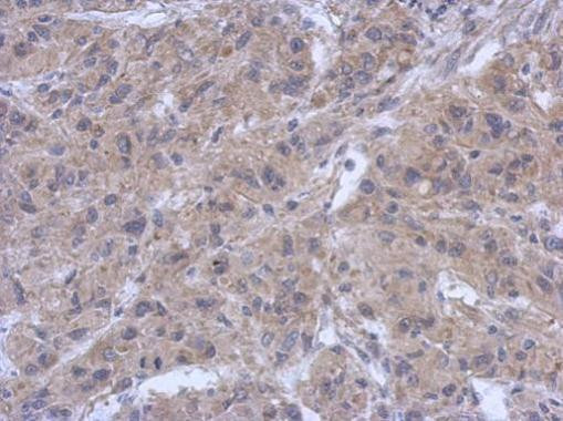 Zap-70 Antibody in Immunohistochemistry (Paraffin) (IHC (P))