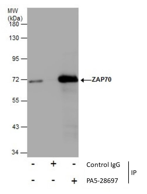 Zap-70 Antibody in Immunoprecipitation (IP)