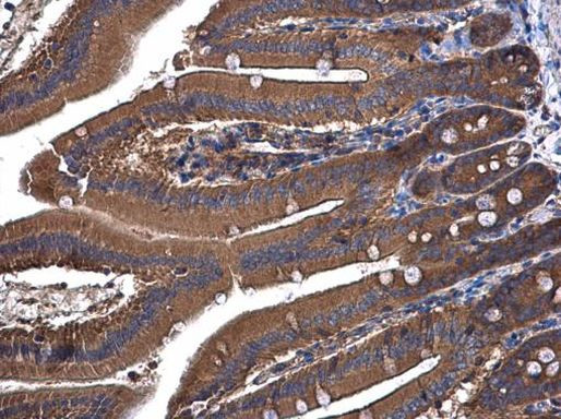 UGP2 Antibody in Immunohistochemistry (Paraffin) (IHC (P))