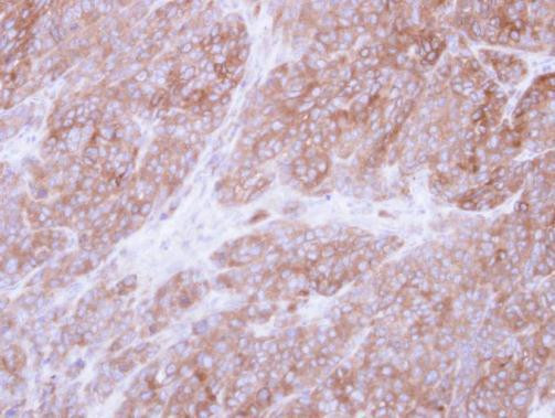 UGP2 Antibody in Immunohistochemistry (Paraffin) (IHC (P))