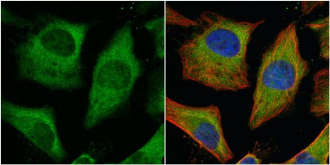 PKM2 Antibody in Immunocytochemistry (ICC/IF)