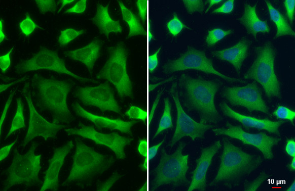 PKM2 Antibody in Immunocytochemistry (ICC/IF)