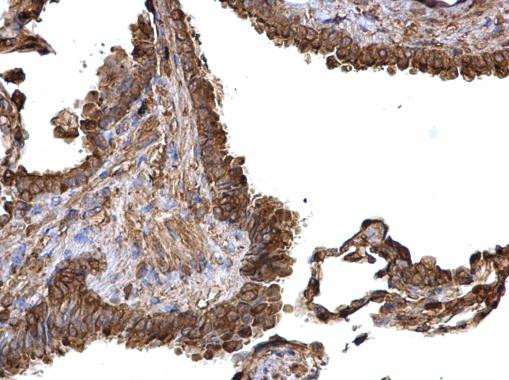 PKM2 Antibody in Immunohistochemistry (Paraffin) (IHC (P))