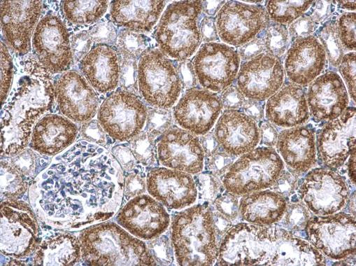 PUM2 Antibody in Immunohistochemistry (Paraffin) (IHC (P))