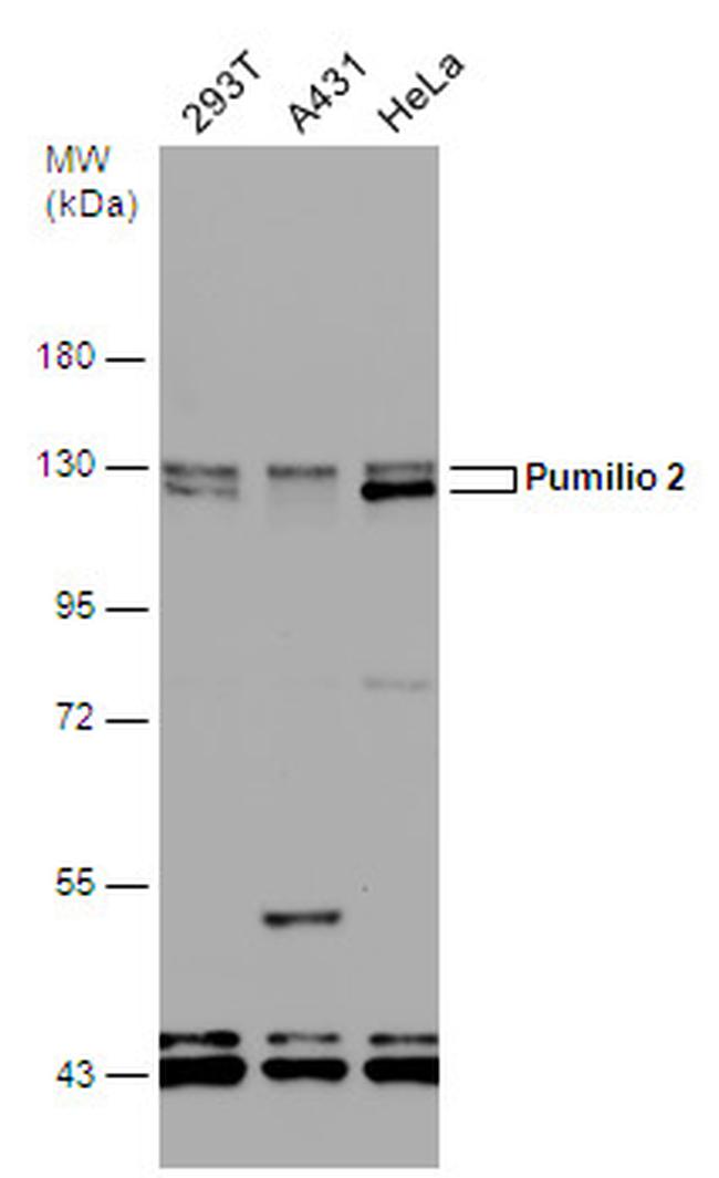 PUM2 Antibody in Western Blot (WB)