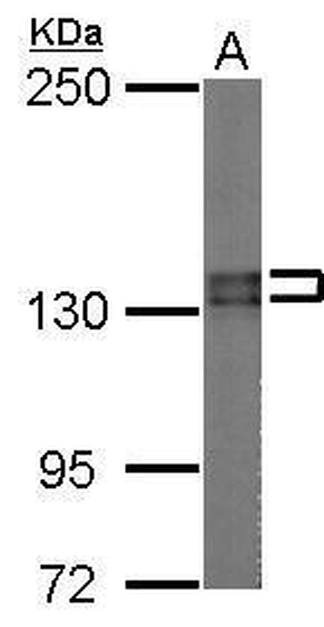 PUM2 Antibody in Western Blot (WB)