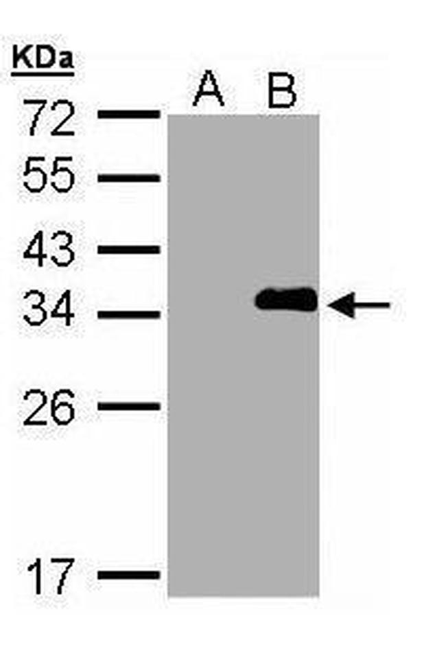 LASP1 Antibody in Western Blot (WB)