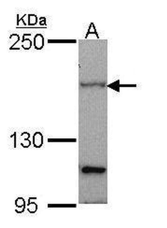 PTCH Antibody in Western Blot (WB)