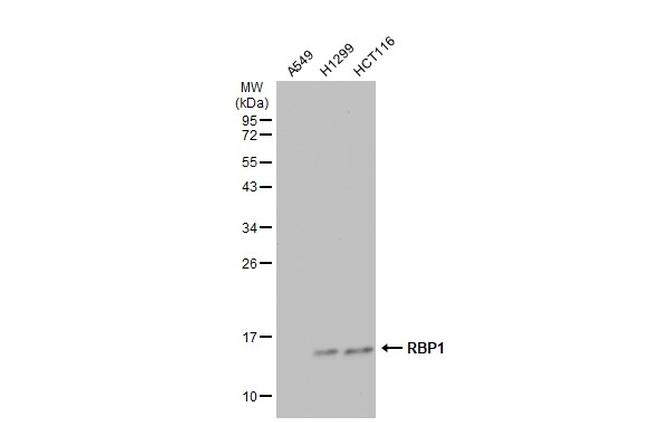 RBP1 Antibody in Western Blot (WB)