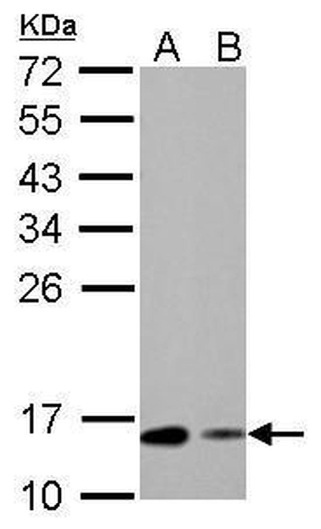 RBP1 Antibody in Western Blot (WB)