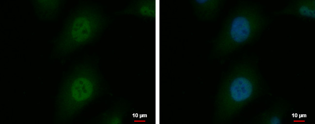 SNUPN Antibody in Immunocytochemistry (ICC/IF)