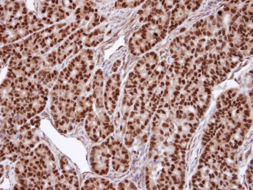 SNUPN Antibody in Immunohistochemistry (Paraffin) (IHC (P))