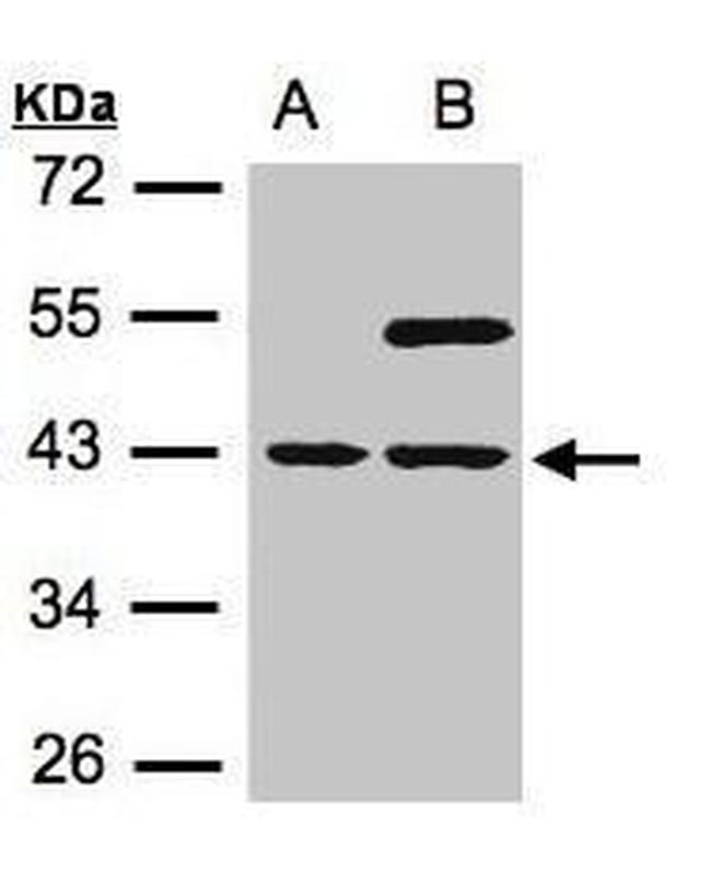 SNUPN Antibody in Western Blot (WB)