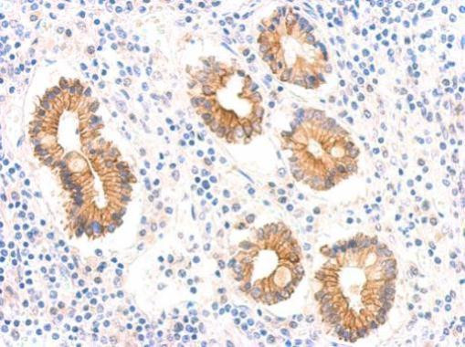 AMID Antibody in Immunohistochemistry (Paraffin) (IHC (P))