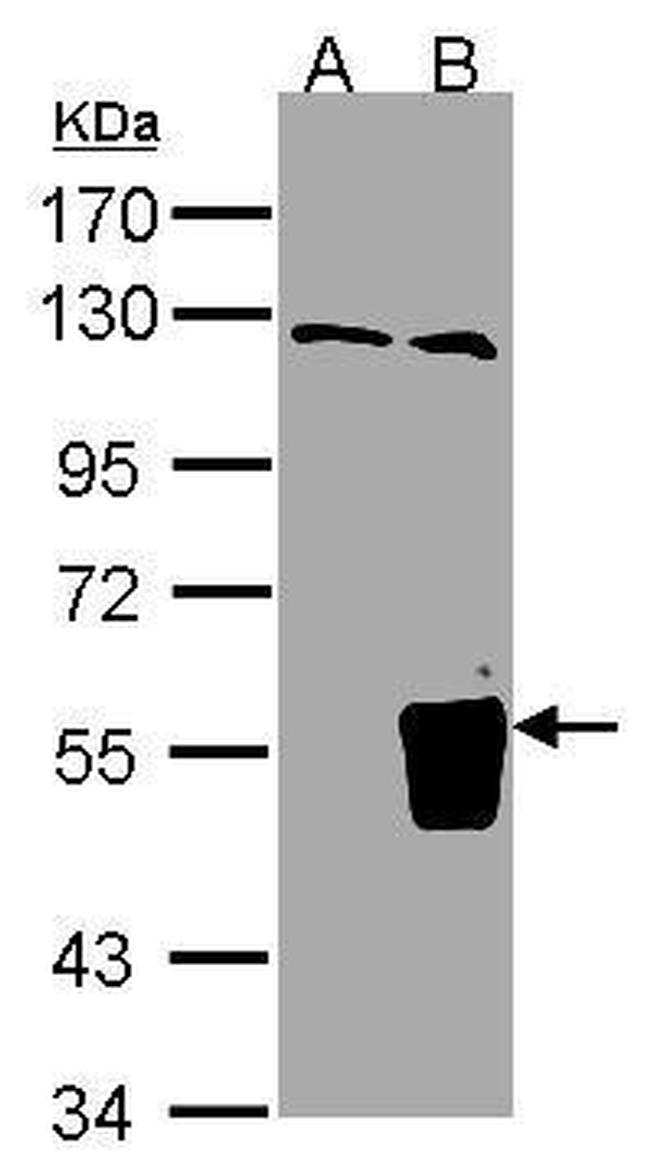 TRIM15 Antibody in Western Blot (WB)