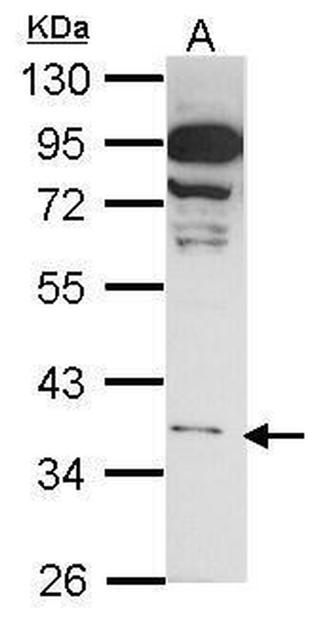 GPR81 Antibody in Western Blot (WB)