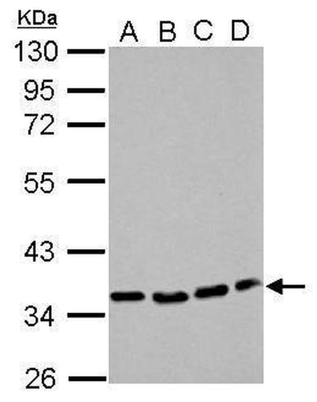 P2Y12 Antibody in Western Blot (WB)
