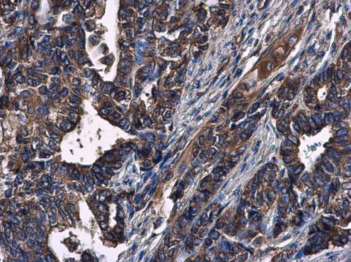 CXCR3 Antibody in Immunohistochemistry (Paraffin) (IHC (P))