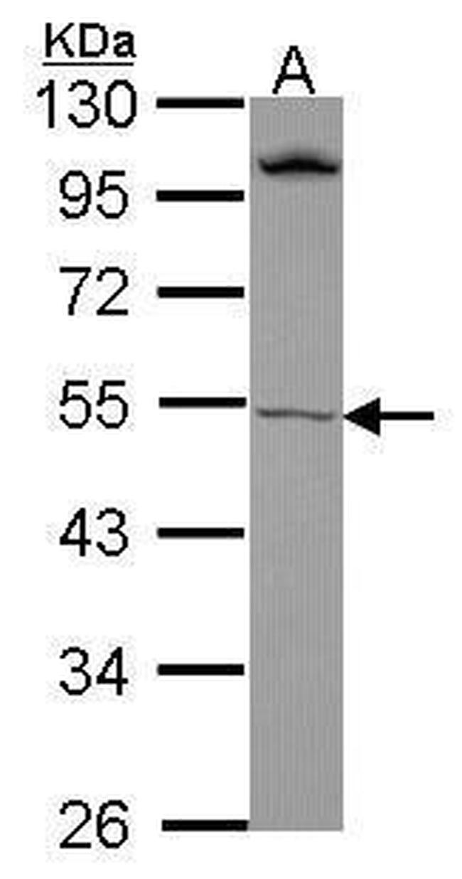 RORB Antibody in Western Blot (WB)