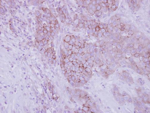 Opsin 3 Antibody in Immunohistochemistry (Paraffin) (IHC (P))