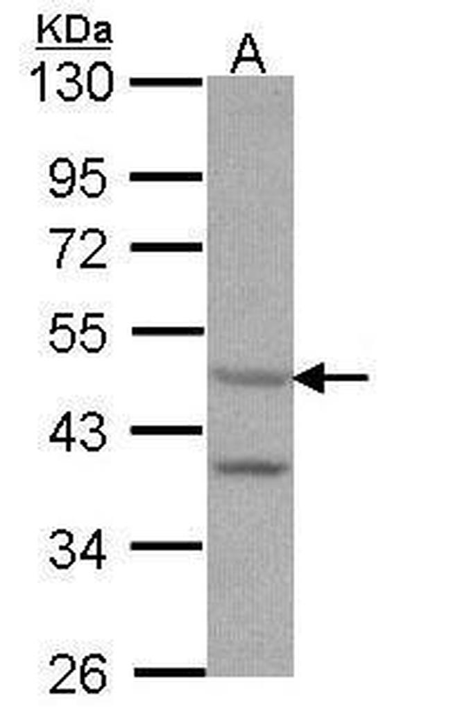 HTR7 Antibody in Western Blot (WB)