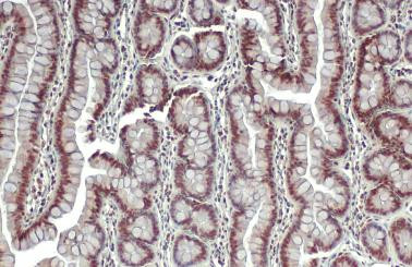 ESRRA Antibody in Immunohistochemistry (Paraffin) (IHC (P))