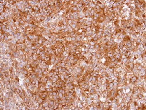 GHSR Antibody in Immunohistochemistry (Paraffin) (IHC (P))