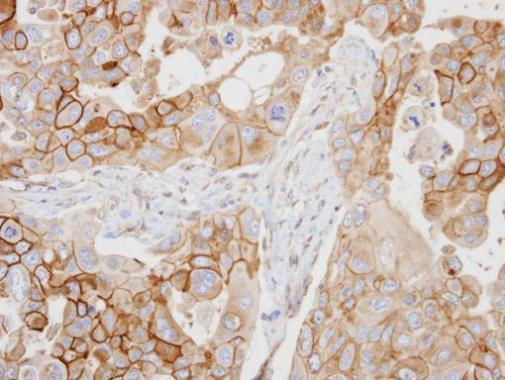 CD97 Antibody in Immunohistochemistry (Paraffin) (IHC (P))