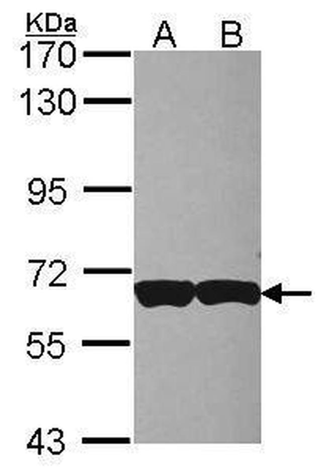 CD97 Antibody in Western Blot (WB)