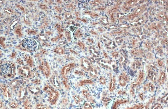 GPRC5C Antibody in Immunohistochemistry (Paraffin) (IHC (P))