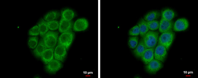 FSHR Antibody in Immunocytochemistry (ICC/IF)