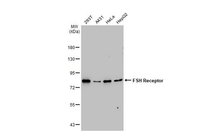 FSHR Antibody in Western Blot (WB)