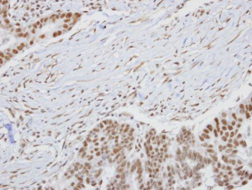 HUNK Antibody in Immunohistochemistry (Paraffin) (IHC (P))