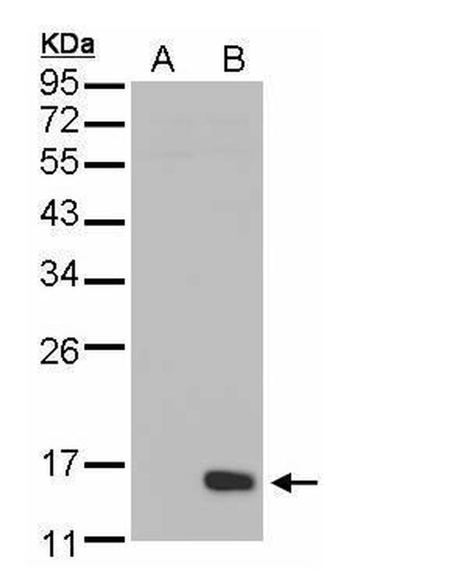 DUSP23 Antibody in Western Blot (WB)