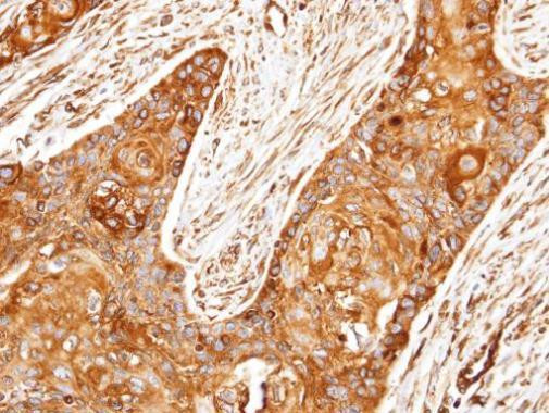 ROCK2 Antibody in Immunohistochemistry (Paraffin) (IHC (P))