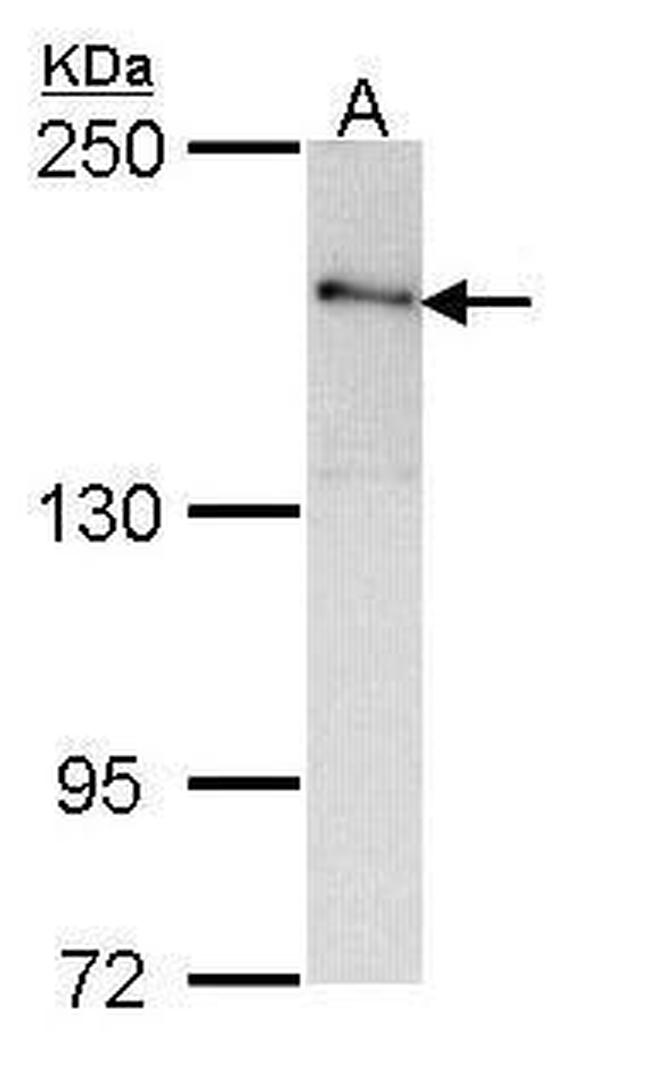 ROCK2 Antibody in Western Blot (WB)