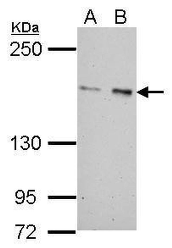 ROCK2 Antibody in Western Blot (WB)